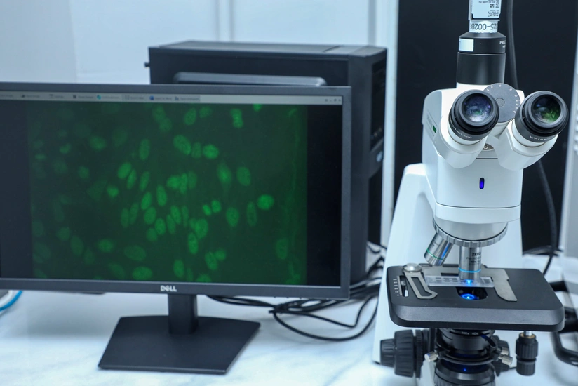 Mərkəzi Neftçilər Xəstəxanasında yeni autoimmun laboratoriyası istifadəyə verilib